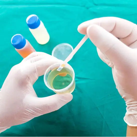 serum bilirubin total test